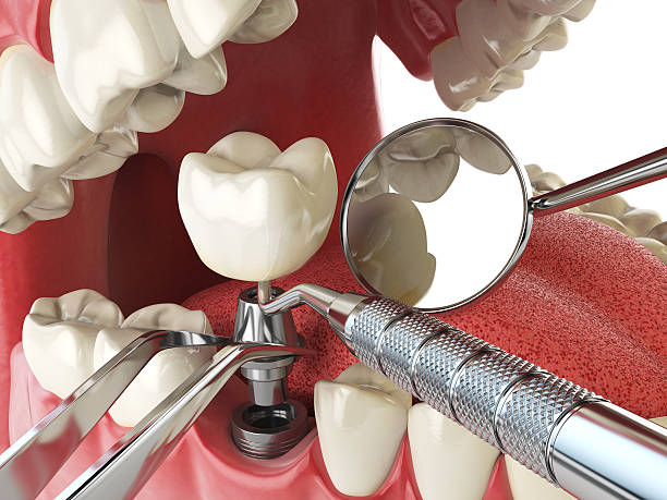 Best Cracked Tooth Emergency Dentist  in Duquesne, PA